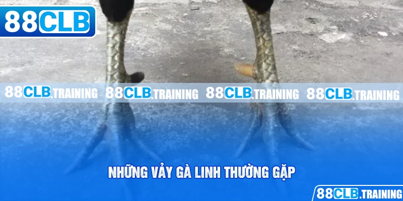 Những Vảy Gà Linh Thường Gặp Và Một Số Điều Cần Biết - GETOXI